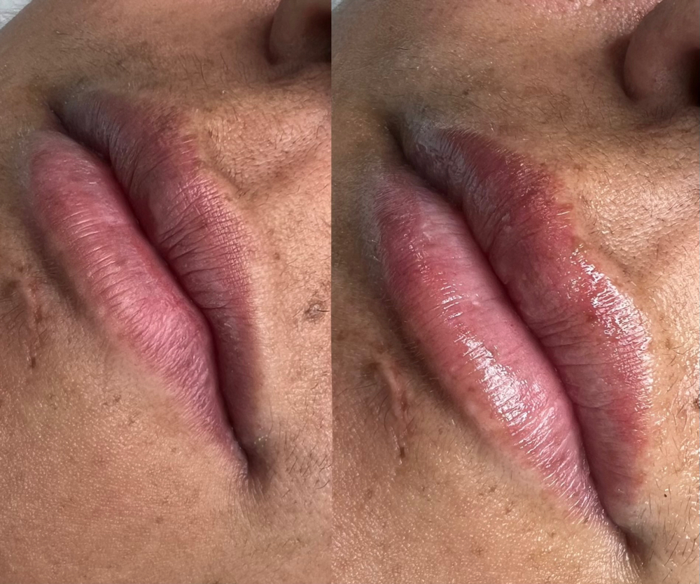 Nano Fusion F-lips