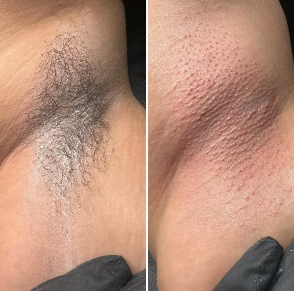 Underarm Wax