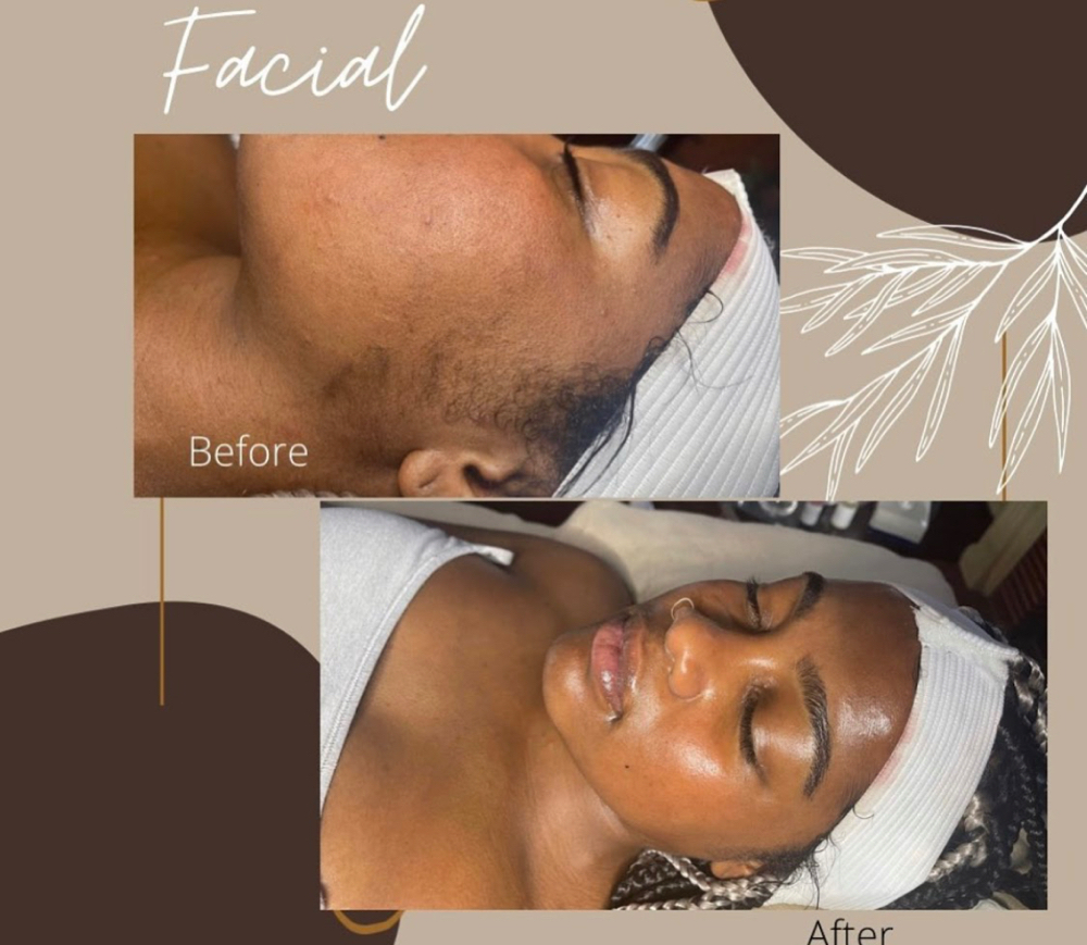 Radiance Corrective Facial at Azura Natural Wellness in Highland, IN