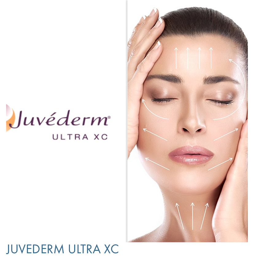 Juvaderm Ultra XC