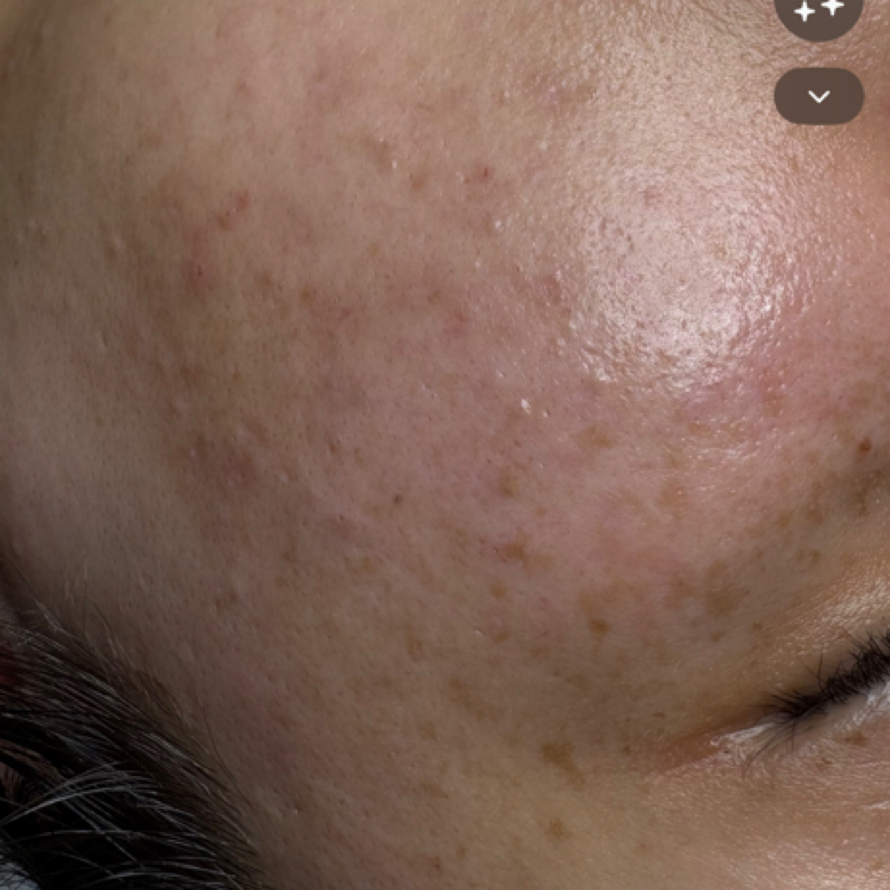 Clear Complexion Facial at Aesthetics by Abby in Alliance, OH