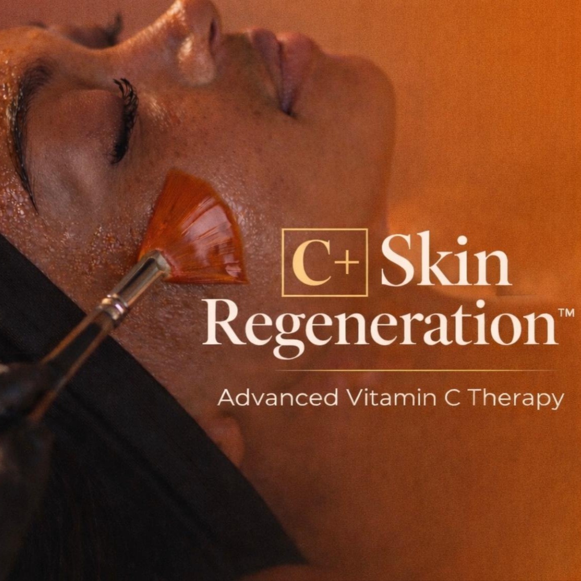 C Plus Skin Regeneration at Marbella Aesthetics Academy & Suites CO in Orlando, FL