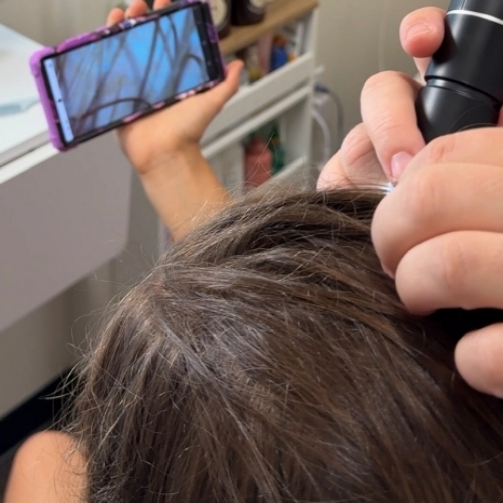 Scalp Wellness Check