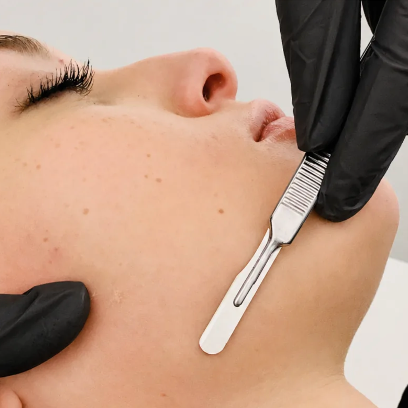Dermaplane at Skin & Aura in Bee Cave, TX