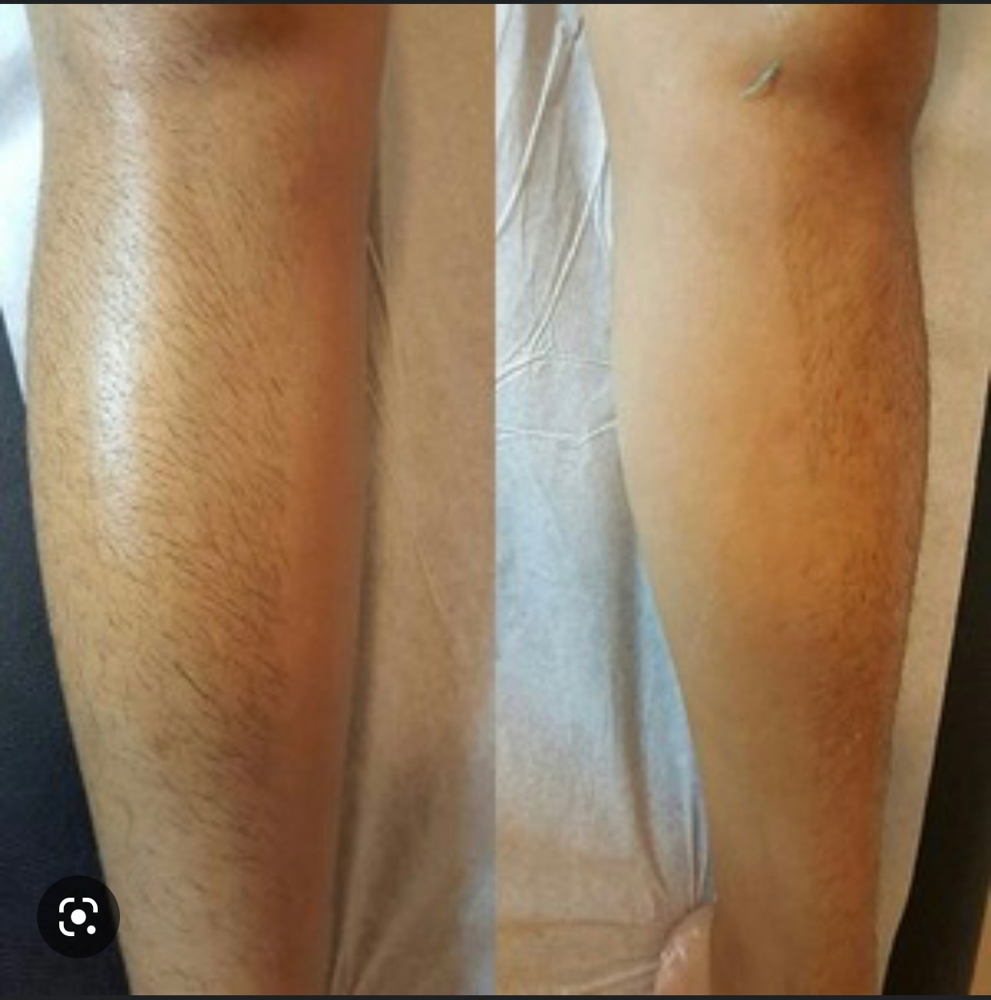 Full Leg