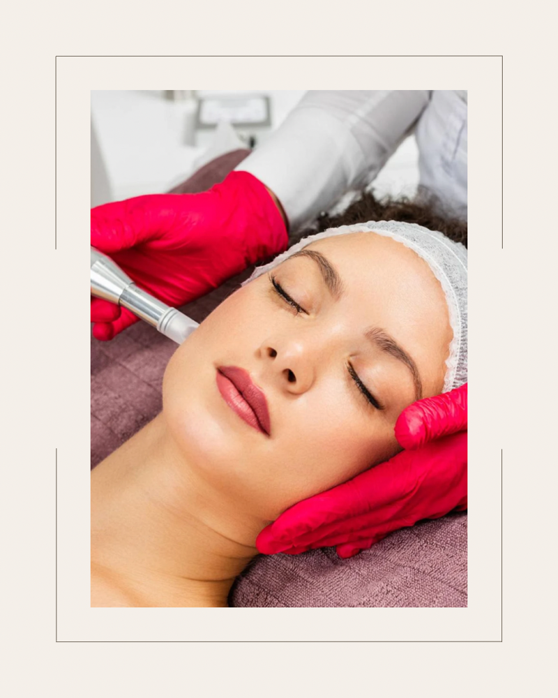 Microneedling Facial