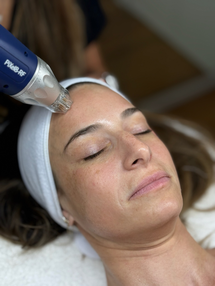 PiXel 8-RF Microneedling