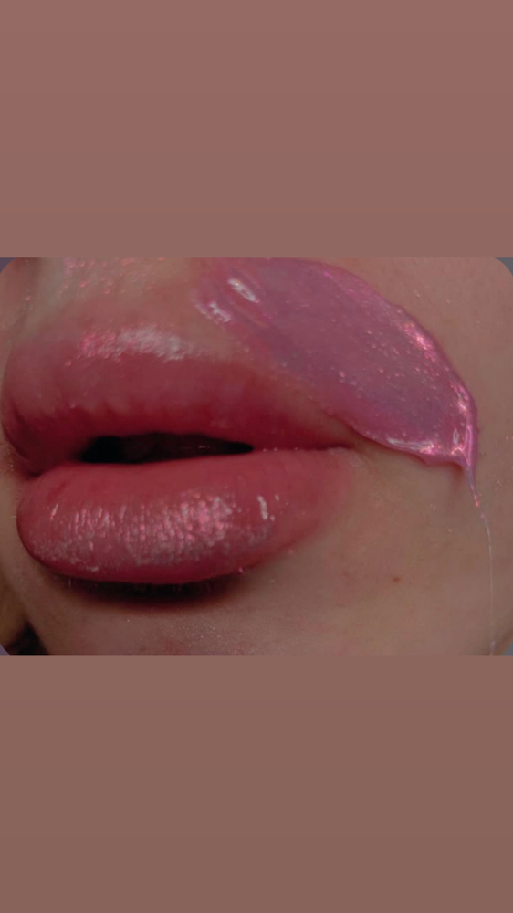 Upper Lip & Chin