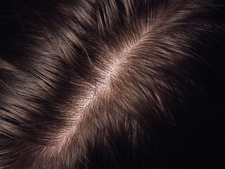Healthy Scalp Treatment at Pretty Parlor By Lyric in Humble, TX