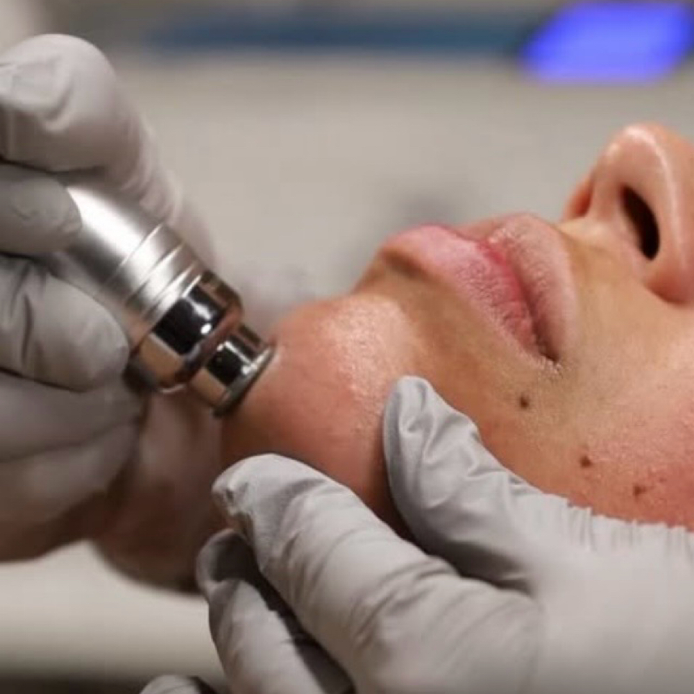 HydroGlow at Fresh Bloom Esthetics in Canton, OH