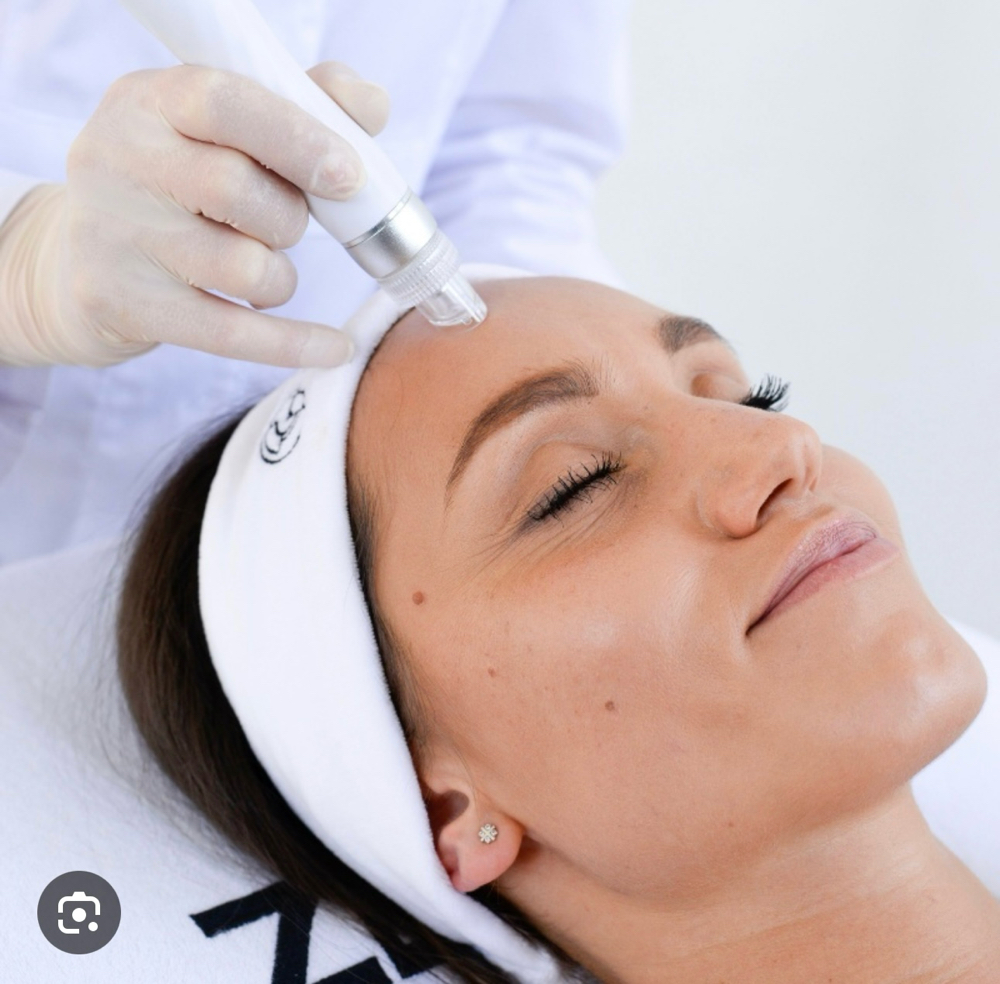 Hydroglow+ mesotherapy + rf