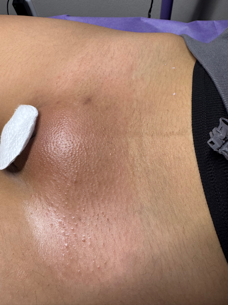 Brazilian Waxing