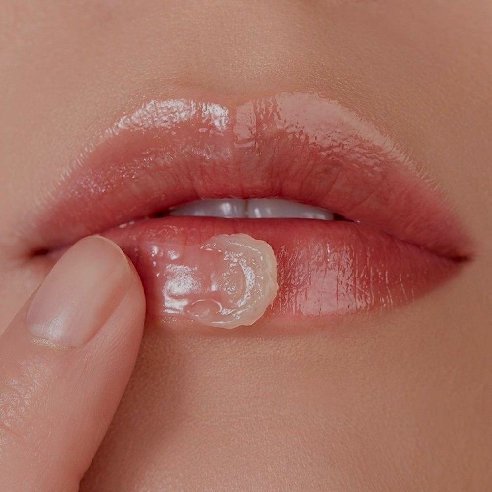 Lip Treatment at Golden Moon Esthetics, LLC in Frisco, TX