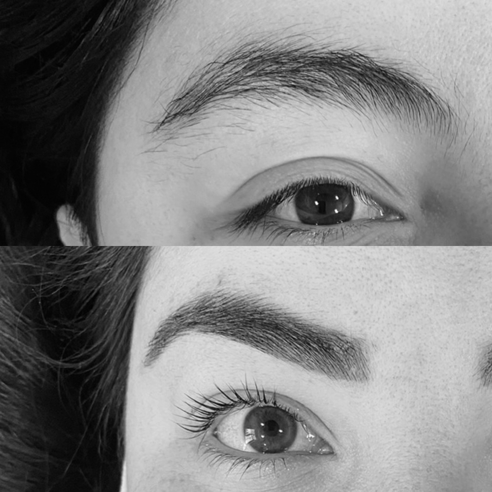 Brow Transformation