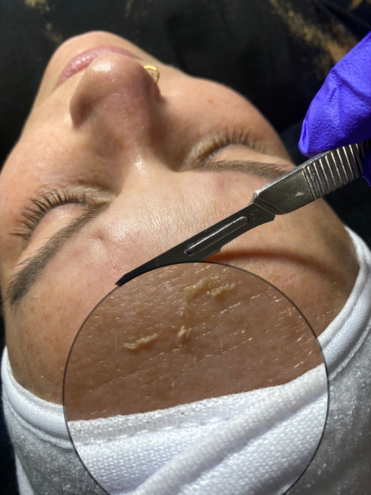 Dermaplane Facial at Southern Tease Salon & Spa in Leesville, LA
