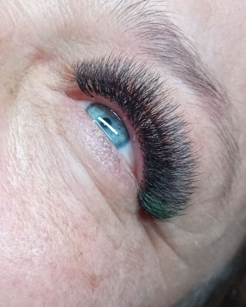 Volume Refill (2 weeks)