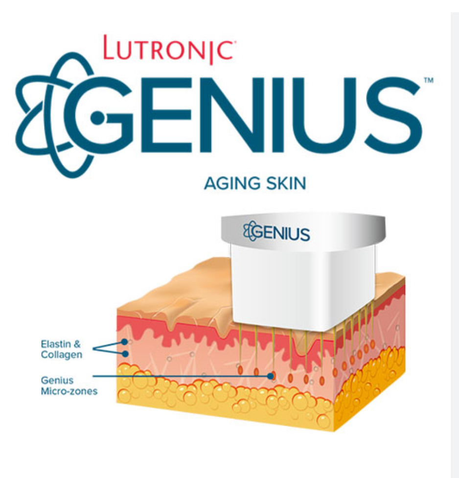Lutronic Genius RF Skin Tightening at Le Reve in Fort worth, TX
