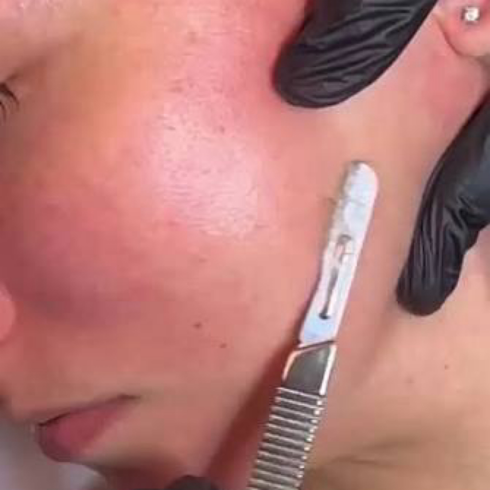 *Dermaplane Special* A Must Have !