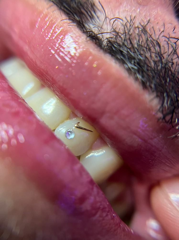Tooth Gems