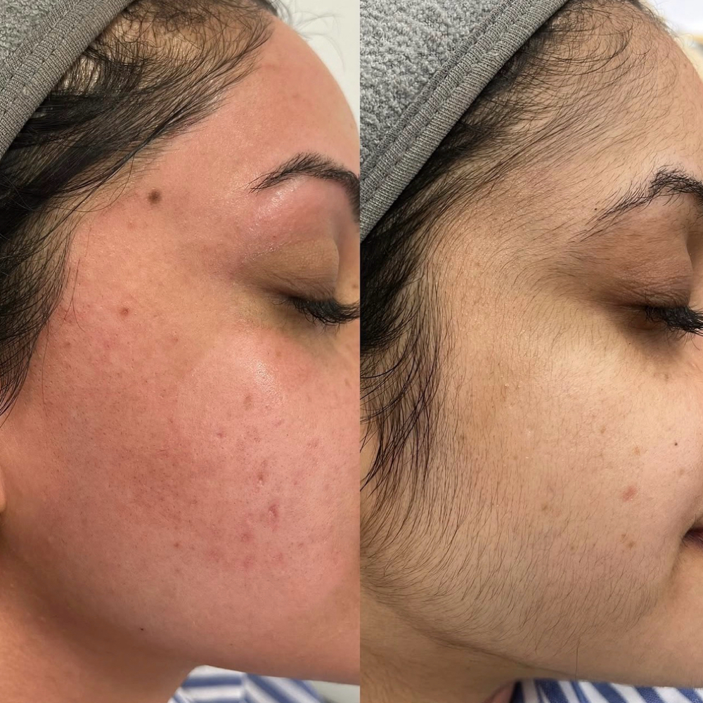 Full Face Waxing at Amethyst Spa in Omaha, NE
