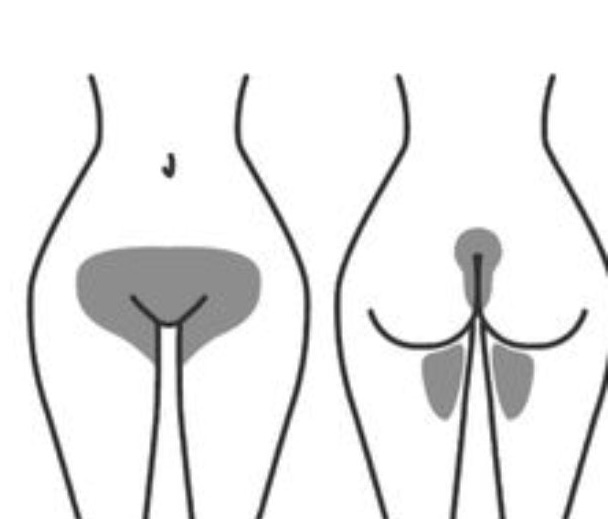 Brazilian Hair Removal at Destiny’s Endless Beauty in Magnolia, TX