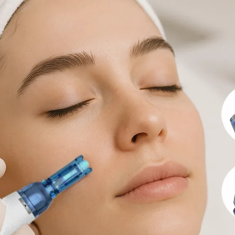 Nano Needling (add-on) at Beauty Glow by Jess in Laredo, TX