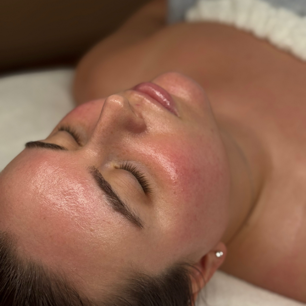 Glow & Go at Elevate Esthetics in Mesa, AZ