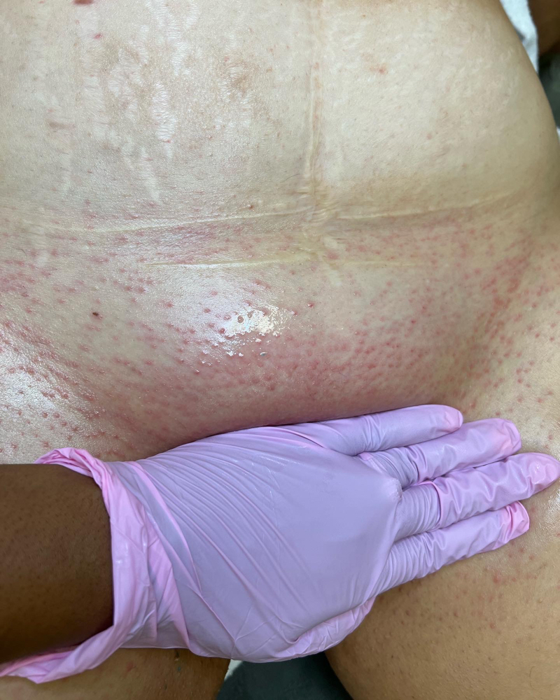 Brazilian Wax For Women