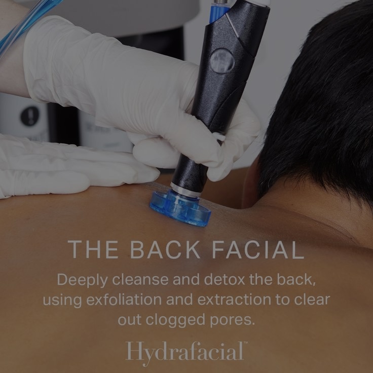 Back Hydrafacial MD