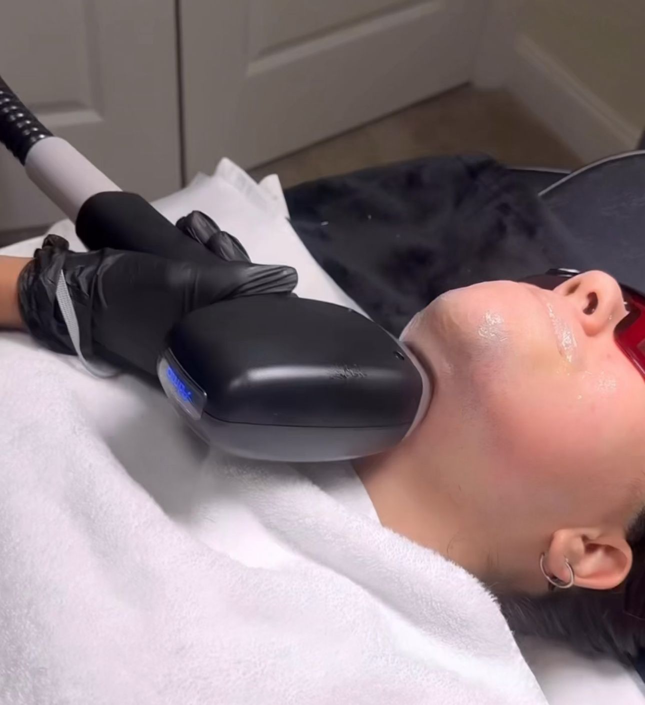 Beard Laser Hair Removal at Windys Beauty Studio LLC in Virginia Beach, VA