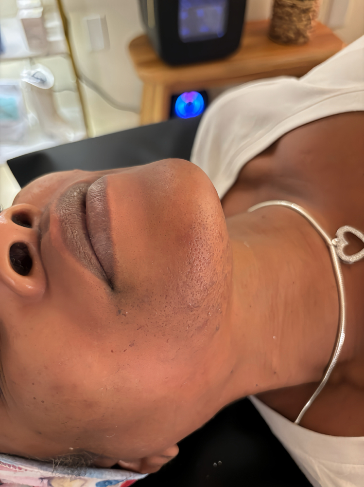 Full Face Wax Or Sugar