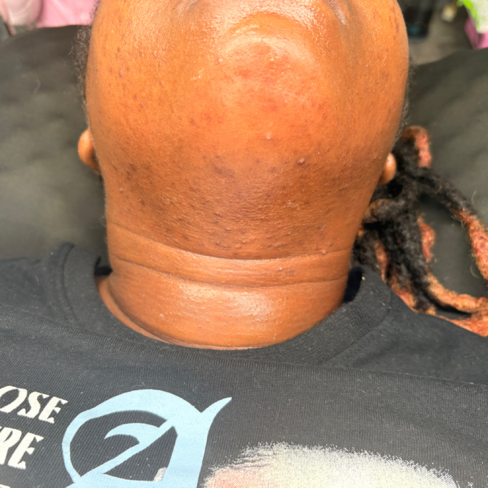 Chin Wax at DANNY’S WAX BOX |Brazilian and Body Waxing Norfolk, V.A. in Norfolk Va, VA