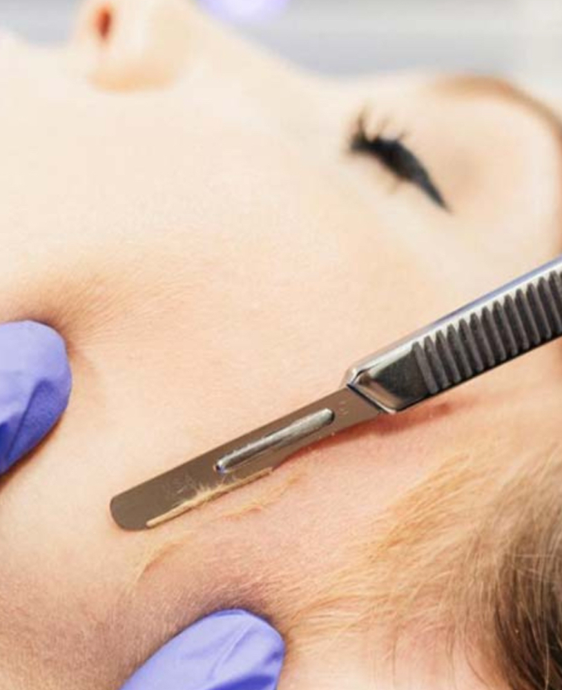 Deluxe Dermaplane Facial - 60 min