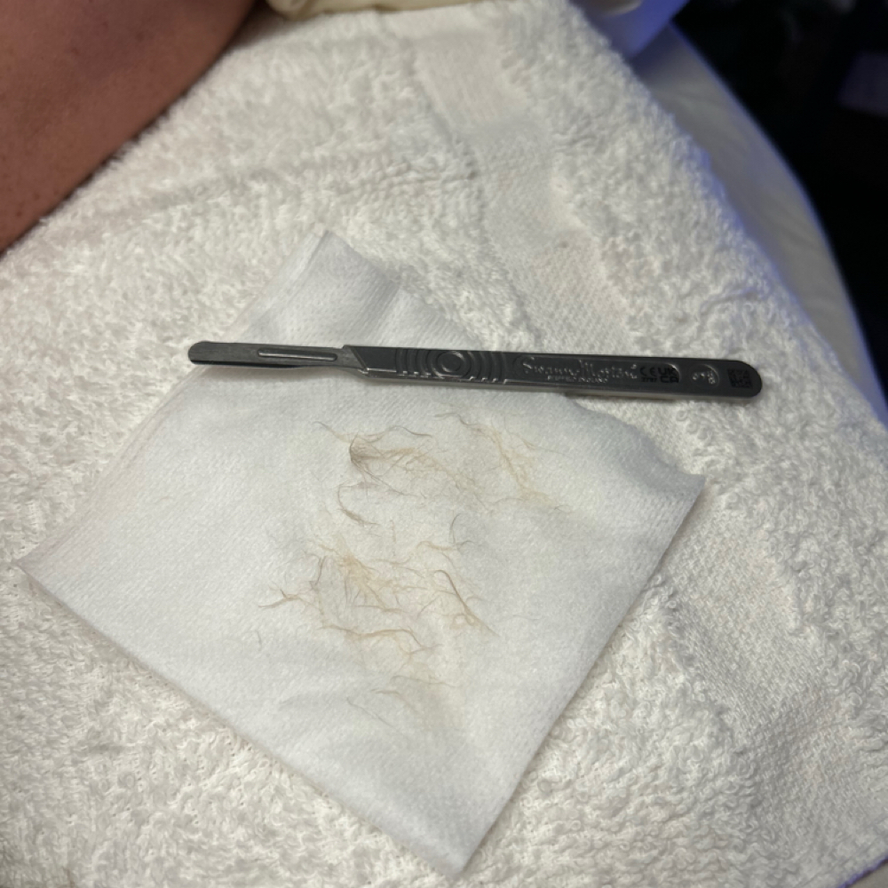 DERMAPLANE ADD ON at Esthetics By Amanda in Albermarle, NC