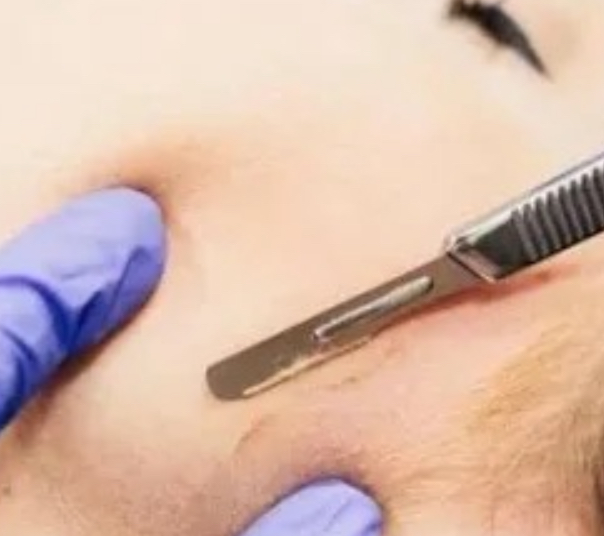 Add-on Dermaplane