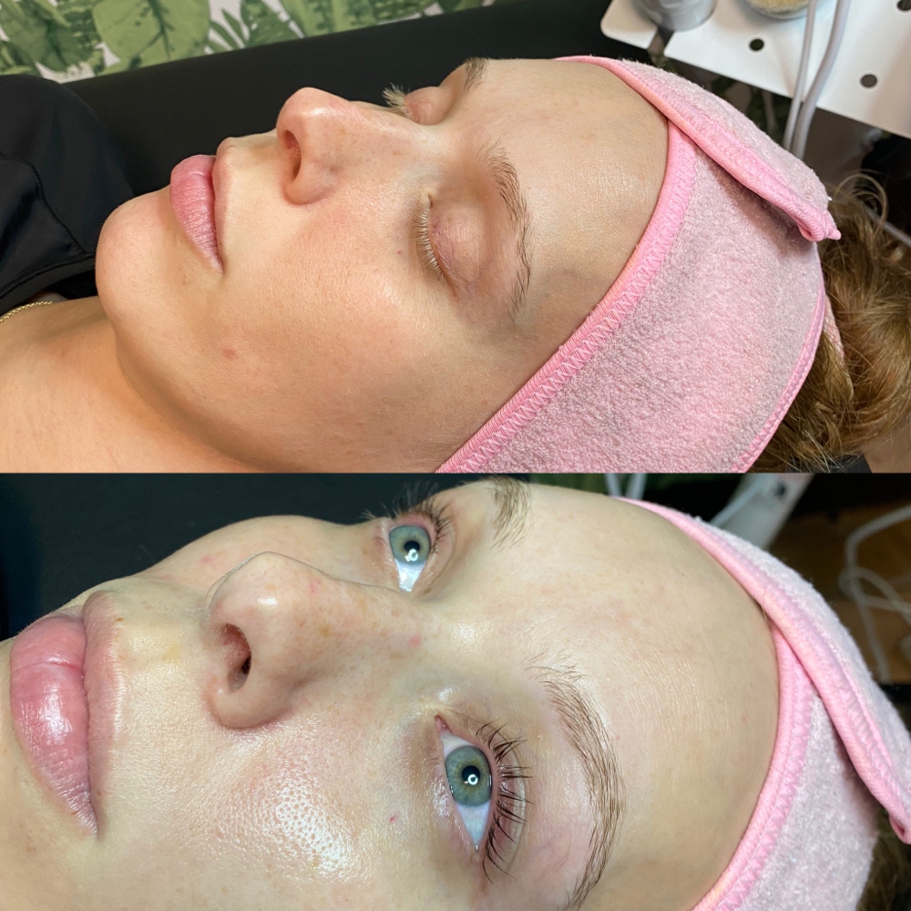 Coconut Enzyme Facial