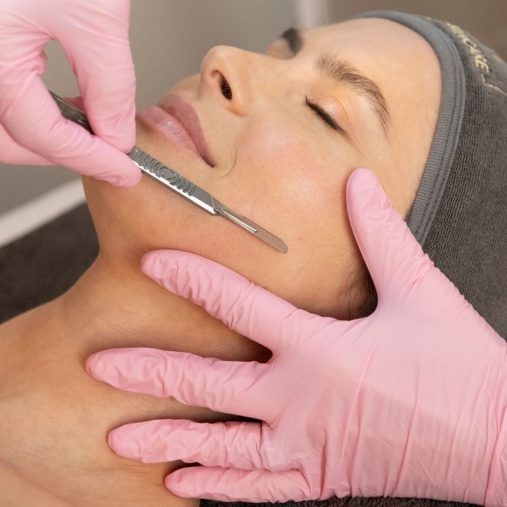 Dermaplaning Facial at Lotus Beauty Center LLC in Eagle Pass, TX