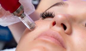 Nano Needling Facial