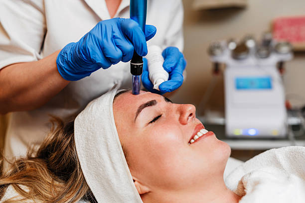 Microneedling Facial