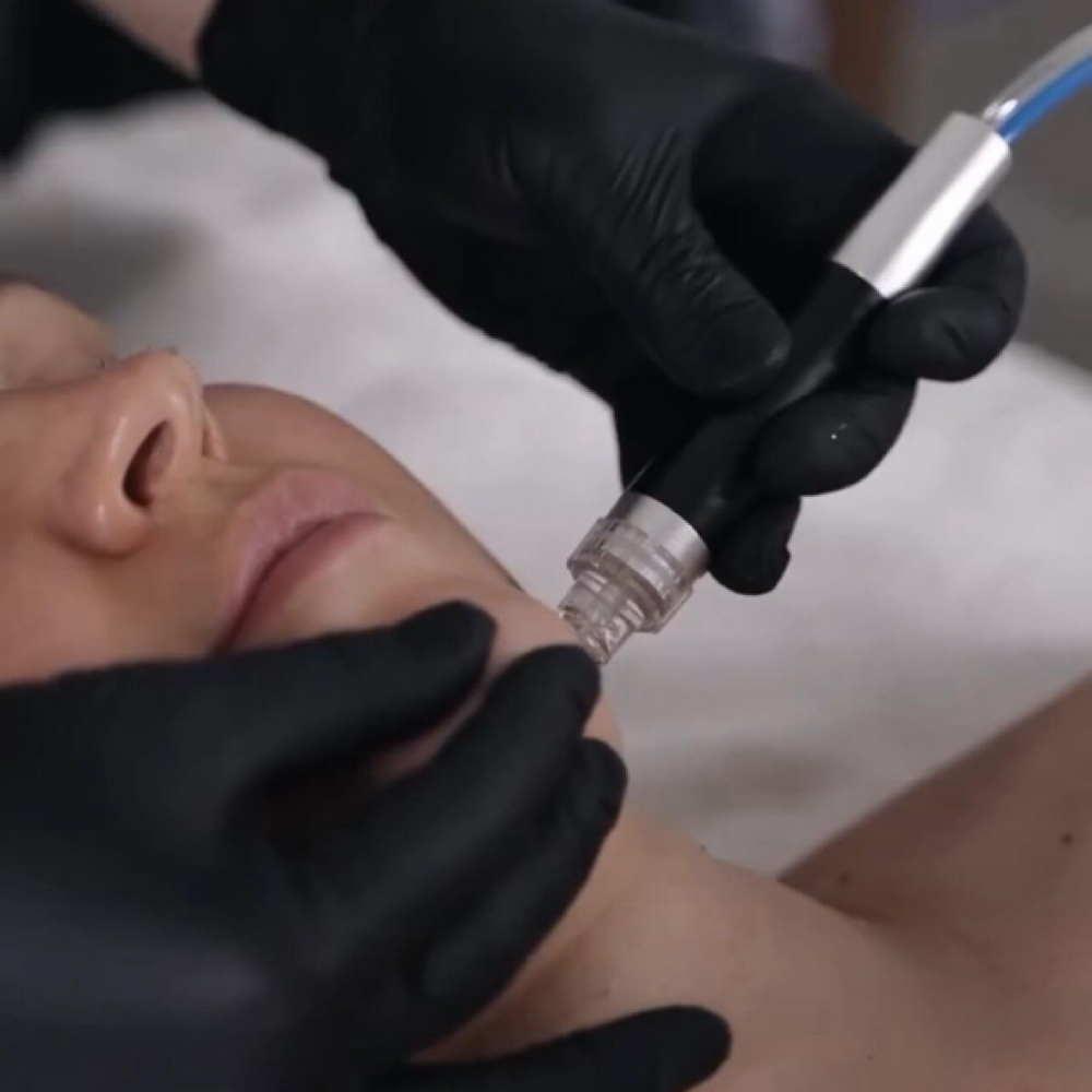 Hydrofacial Detox at GIRONDA MIAMI in MIAMI, FL