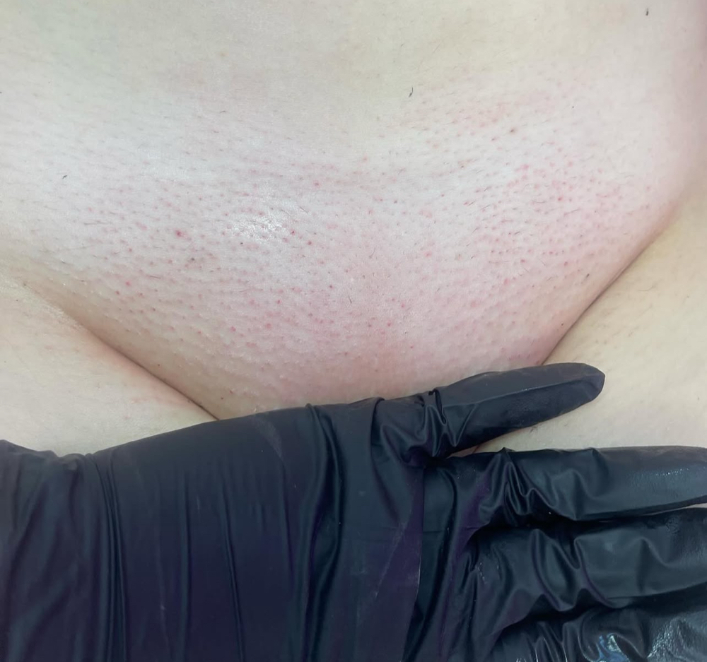 Brazilian wax (Includes Butt strip)