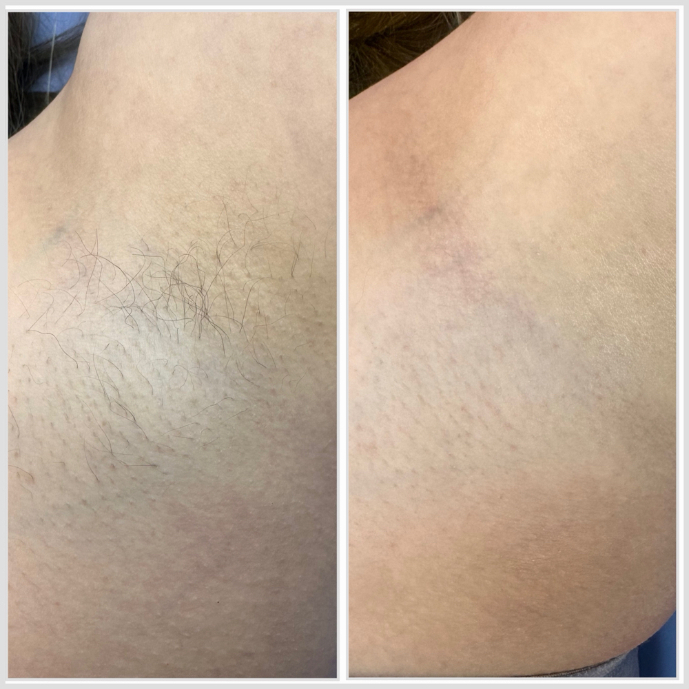 Underarm Wax at Aura House Co in Joliet, IL