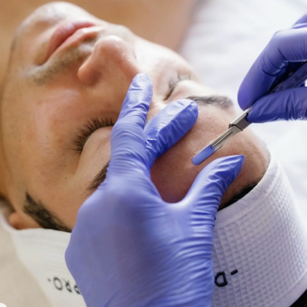 Dermaplane Add On at Glo by Clo Esthetics in Petaluma, CA