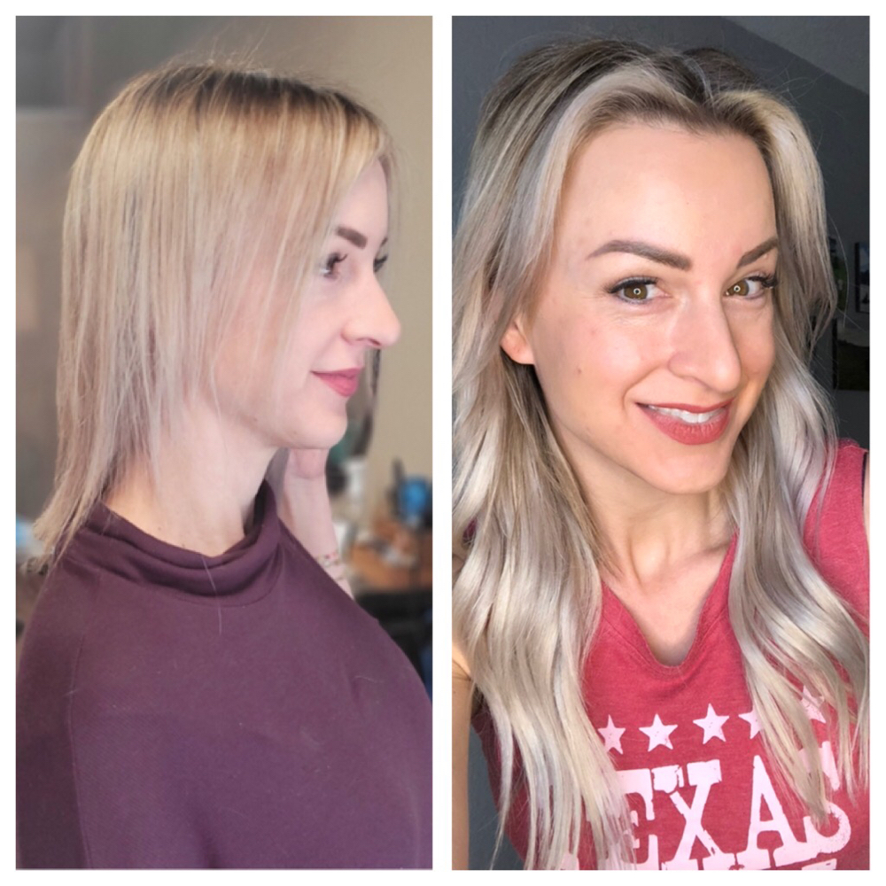 Free Consultation