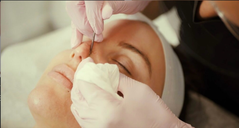 Add Extractions To Any Facial