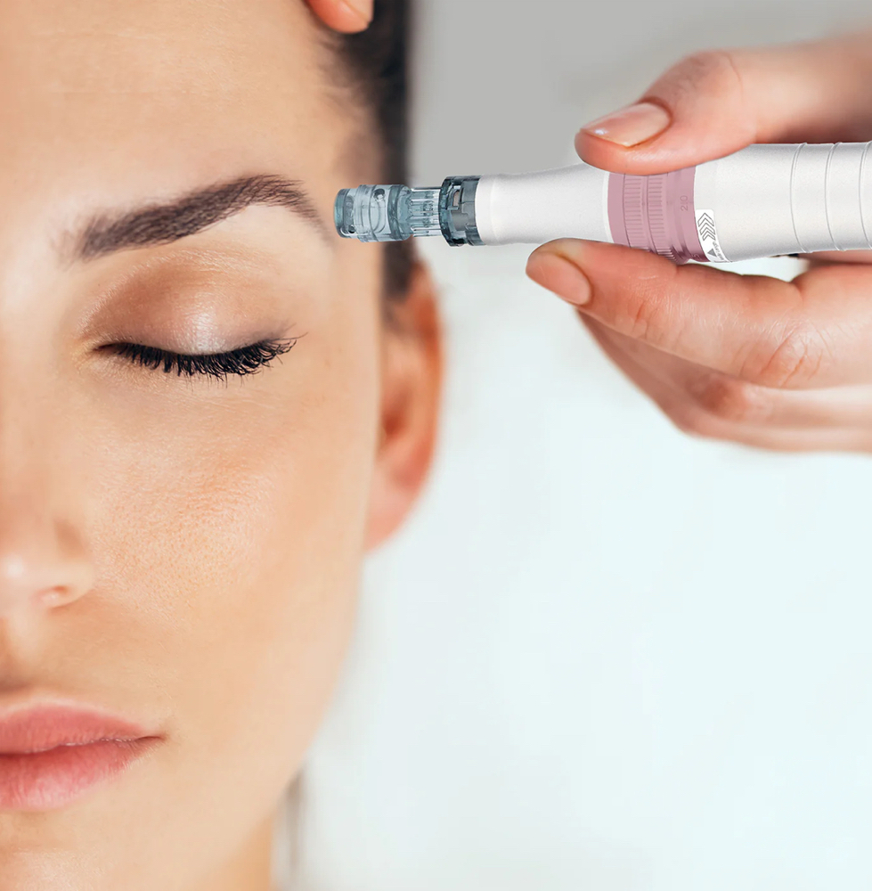Nano-Needling Deep Infusion Facial at Herbal Skin Apothecary Studio in Young Harris, GA