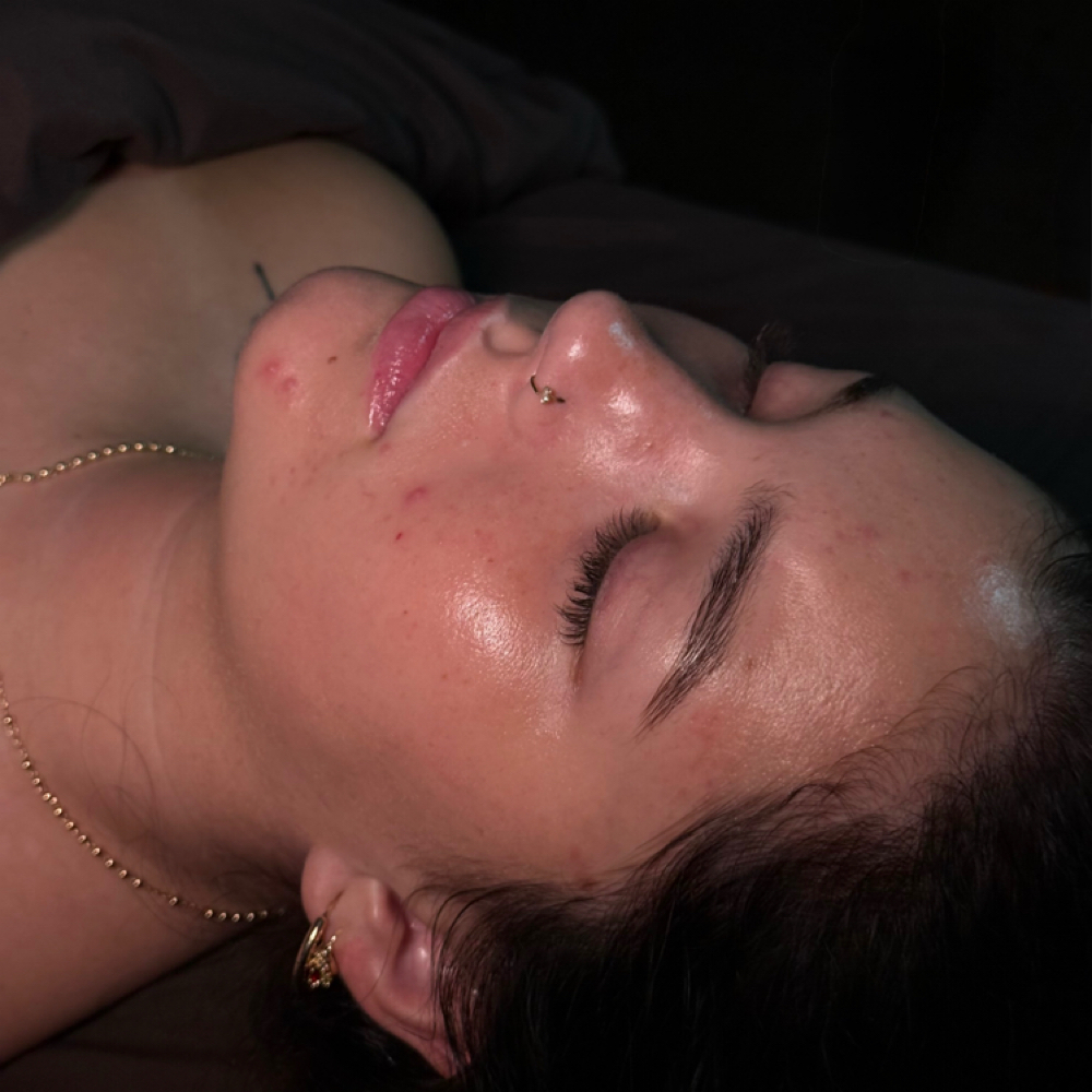 Acne Solution Program *New Client* at Skin Bar by Taya in Chico, CA