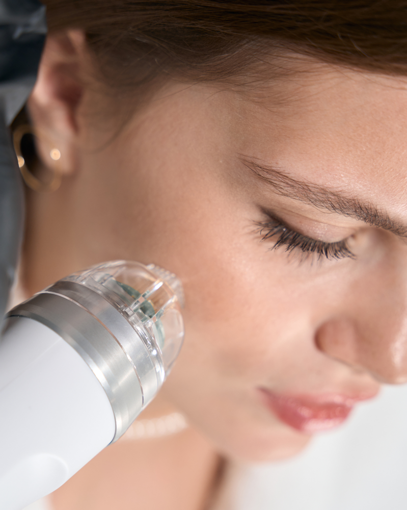 Microneedling + Salmon DNA