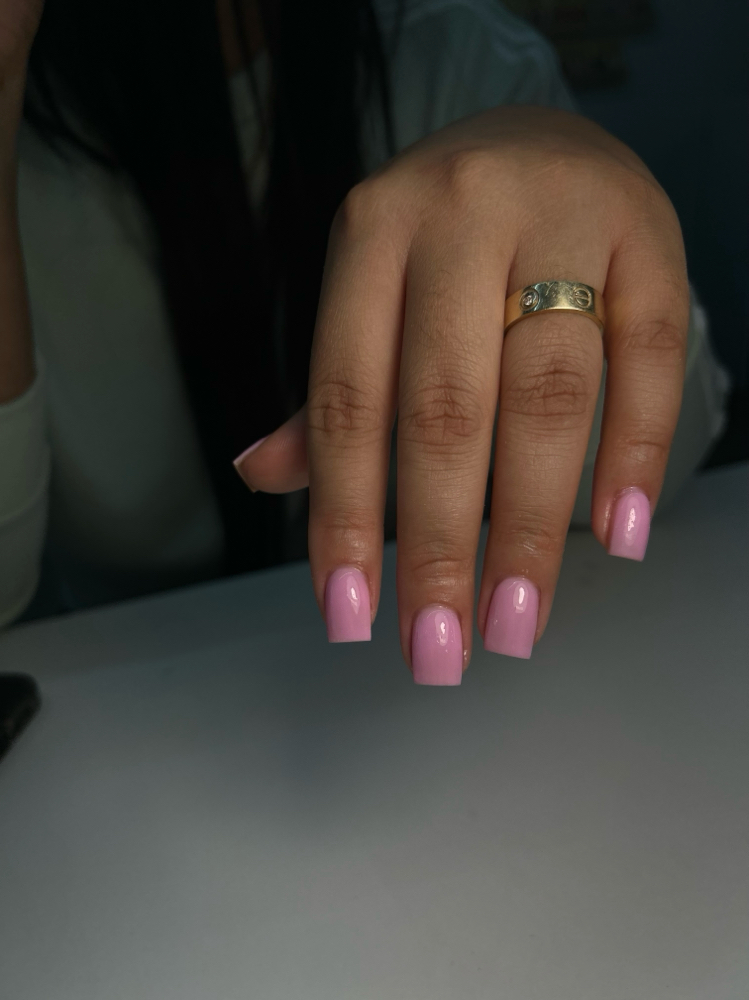 overlays