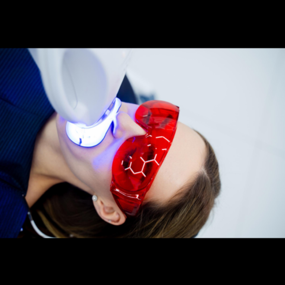 Whitening Model (Contact To Book) at Icey Bodies in St Anthony, MN